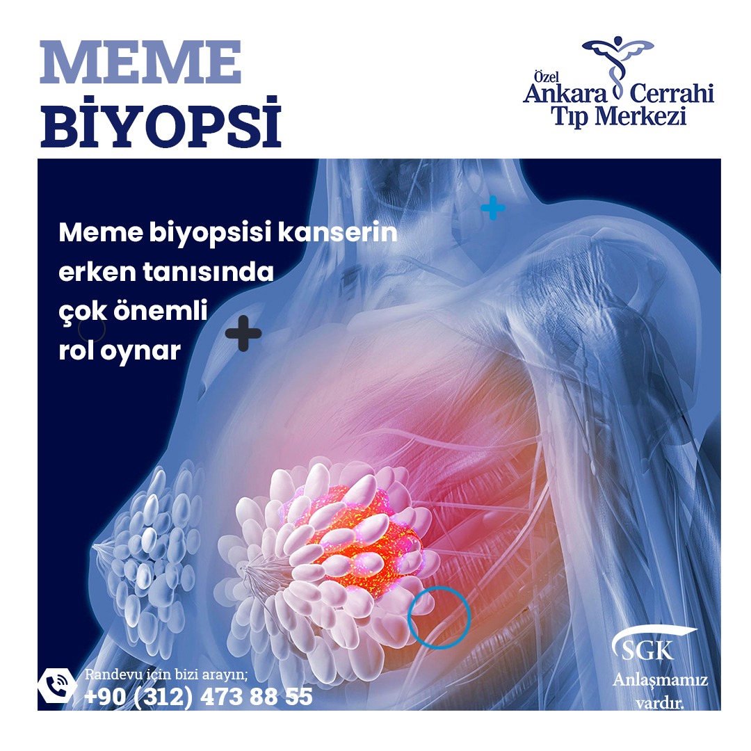 Meme Biyopsisi Nedir?