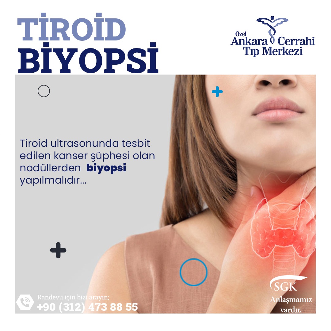 Tiroid İnce İğne Aspirasyon Biyopsisi